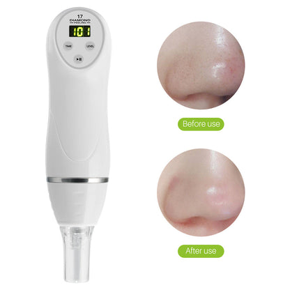Electric pore suction