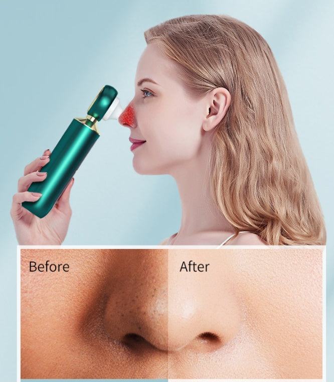 Portable Visual Blackhead